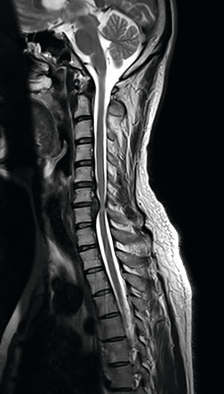 Clinical Illustration