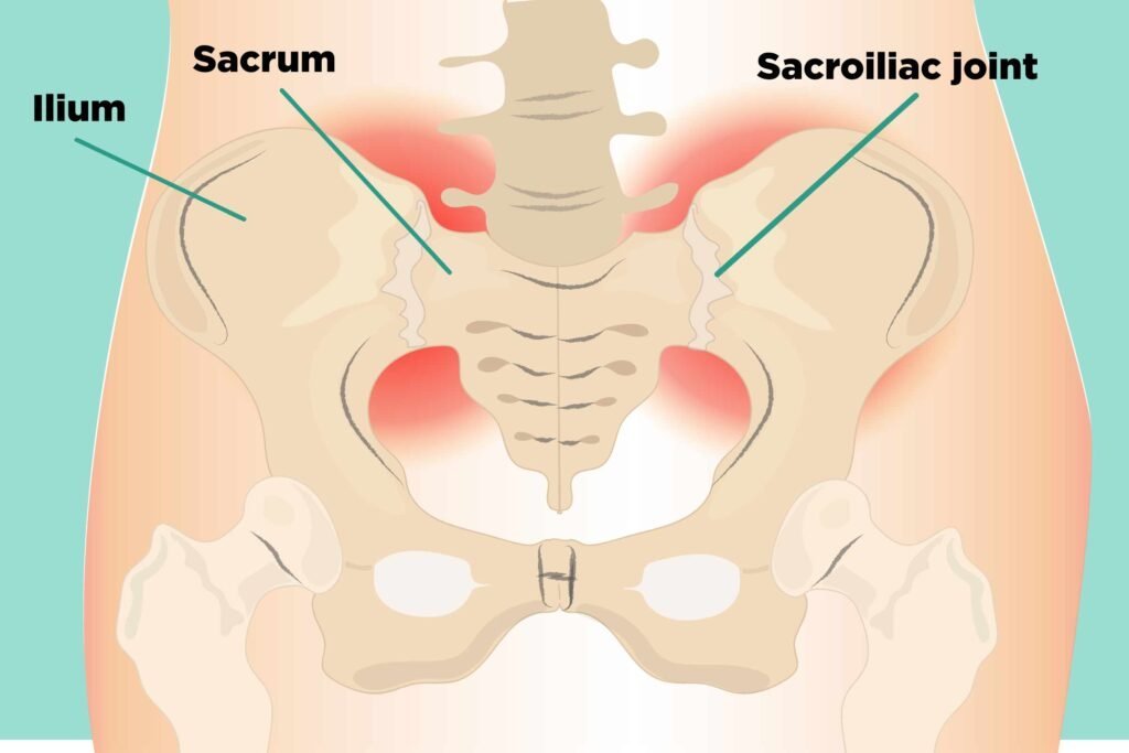Clinical Illustration